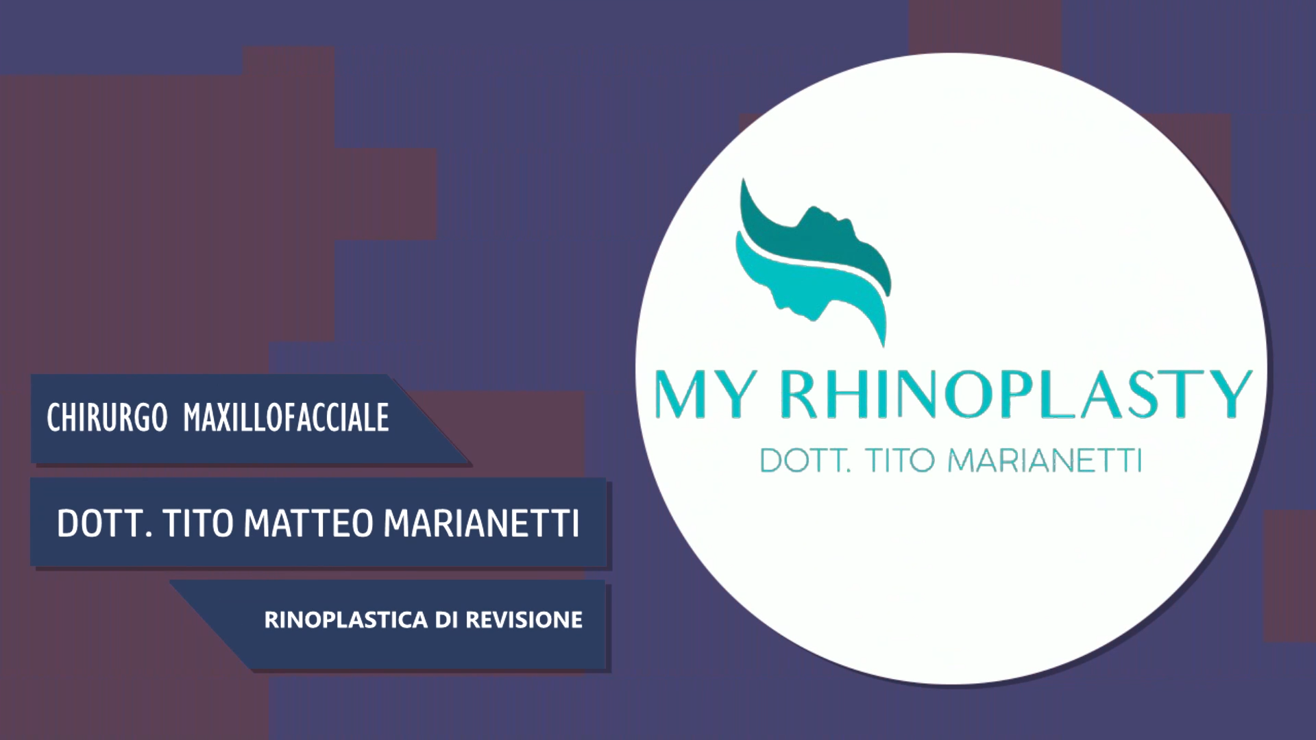 Dott. Tito Marianetti – Rinoplastica di Revisione
