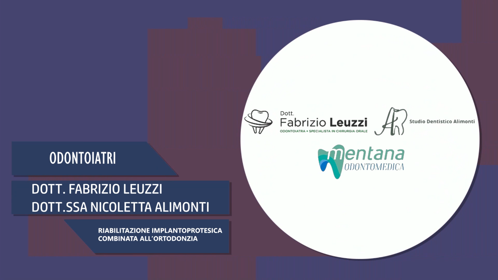 Intervista a Dott. Fabrizio Leuzzi e Dott.ssa Nicoletta Alimonti – Riabilitazione Implantoprotesica