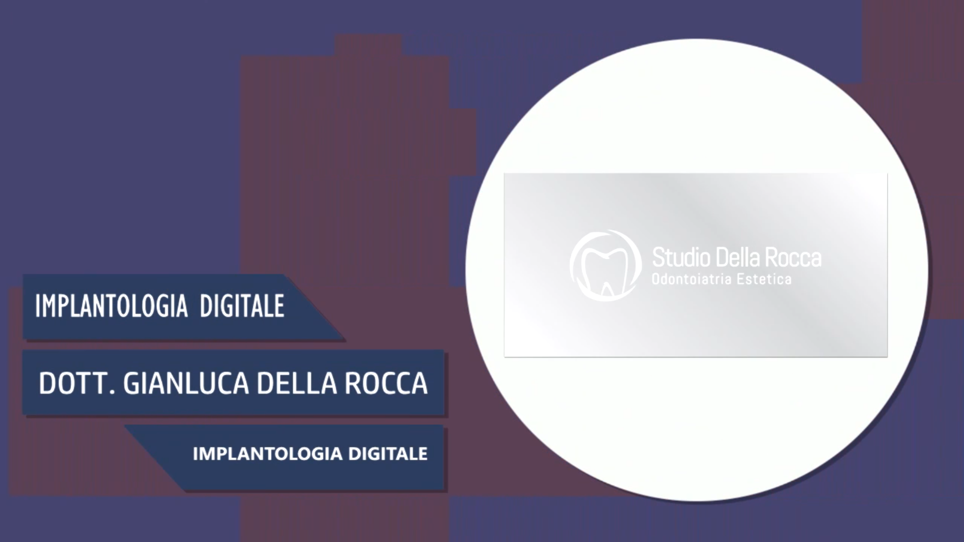 Intervista al Dott. Gianluca Della Rocca – Implantologia digitale