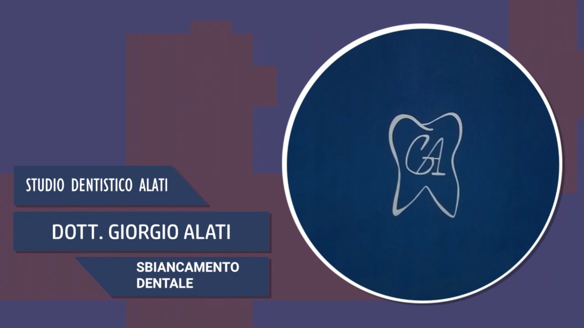Intervista al Dott. Giorgio Alati – Sbiancamento dentale